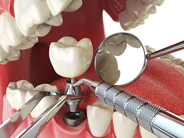 Best Emergency Gum Treatment in West Monroe, MI